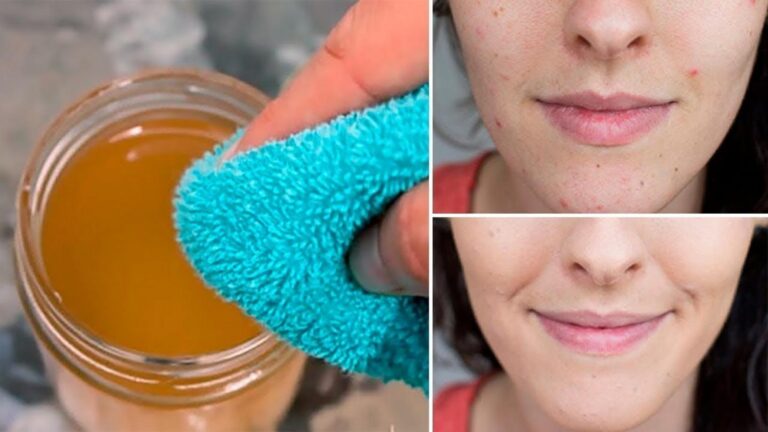 Dieser einfache Trick mit Apfelessig könnte deine Haut in nur 5 Tagen revolutionieren…