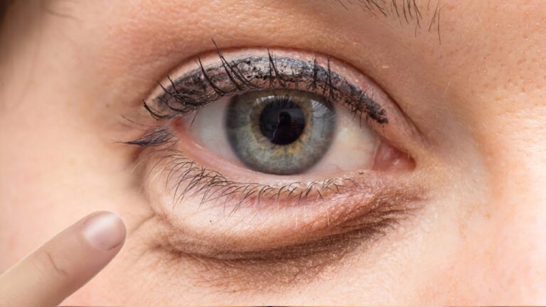 6 effektive Tipps gegen Augenringe, die du sofort ausprobieren kannst!
