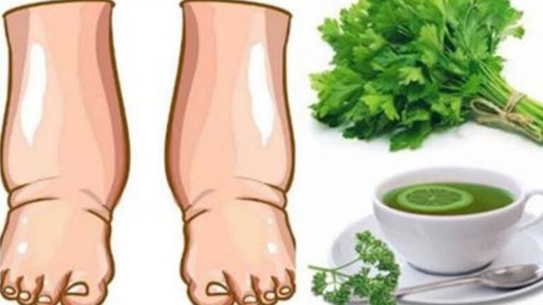 5 einfache Schritte für das perfekte Tee-Rezept gegen geschwollene Beine!