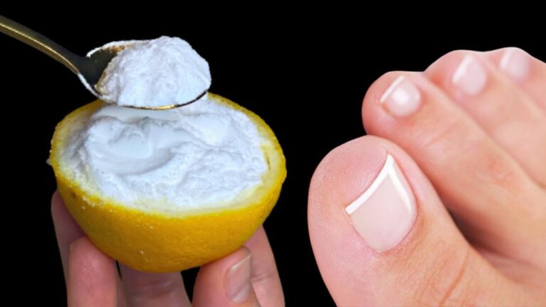 Entferne Nagelpilz in 3 Tagen mit diesem natürlichen Wundermittel!