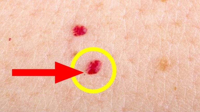 5 Ursachen für rote Punkte auf der Haut und wann du handeln solltest!
